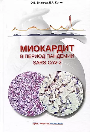 Миокардит в период пандемии SARS-CoV-2 — 2988190 — 1
