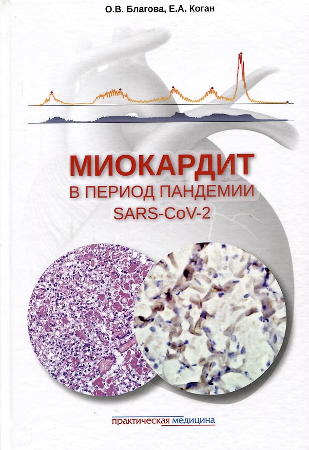 Книга Миокардит в период пандемии SARS-CoV-2 (Ольга Благова, Евгения Коган) — 1