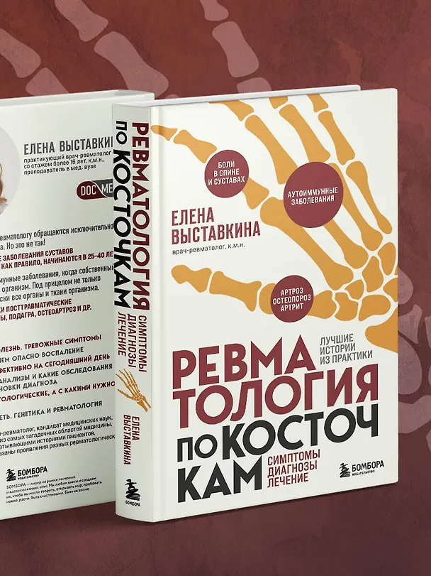 Книга Ревматология по косточкам. Симптомы, диагнозы, лечение (Елена Выставкина) — 14