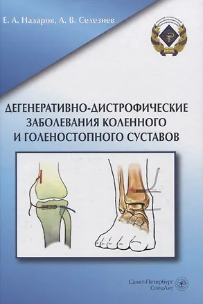 Книга Дегенеративно-дистрофические заболевания коленного и голеностопного суставов ()