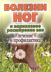Болезни ног и варикозное расширение вен.Лечение и профилактика