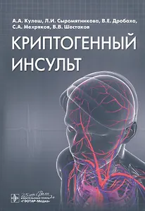 Криптогенный инсульт. Руководство