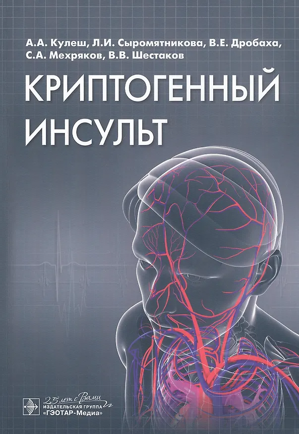 Книга Криптогенный инсульт. Руководство (Алексей Кулеш) — 1