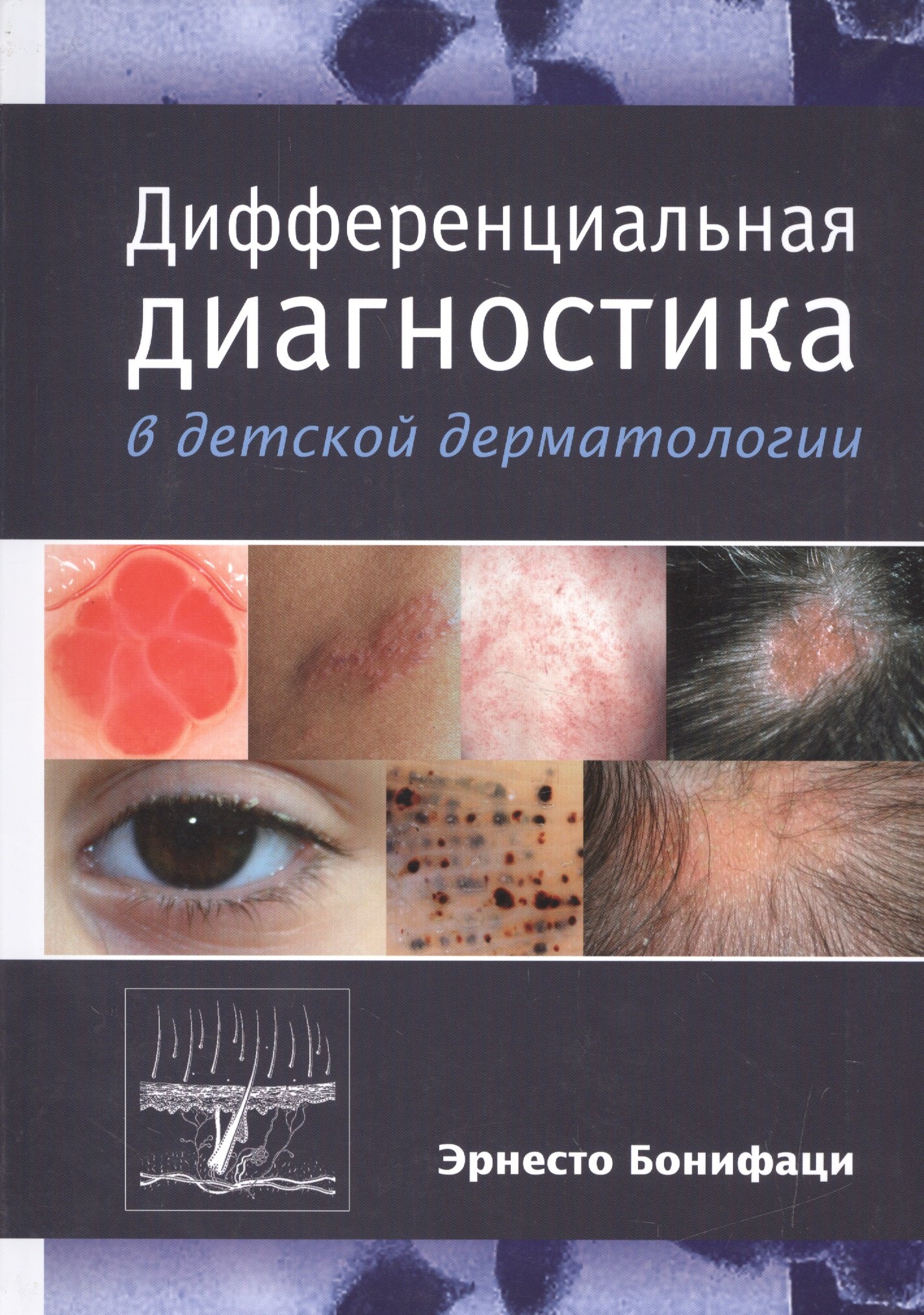 

Дифференциальная диагностика в детской дерматологии