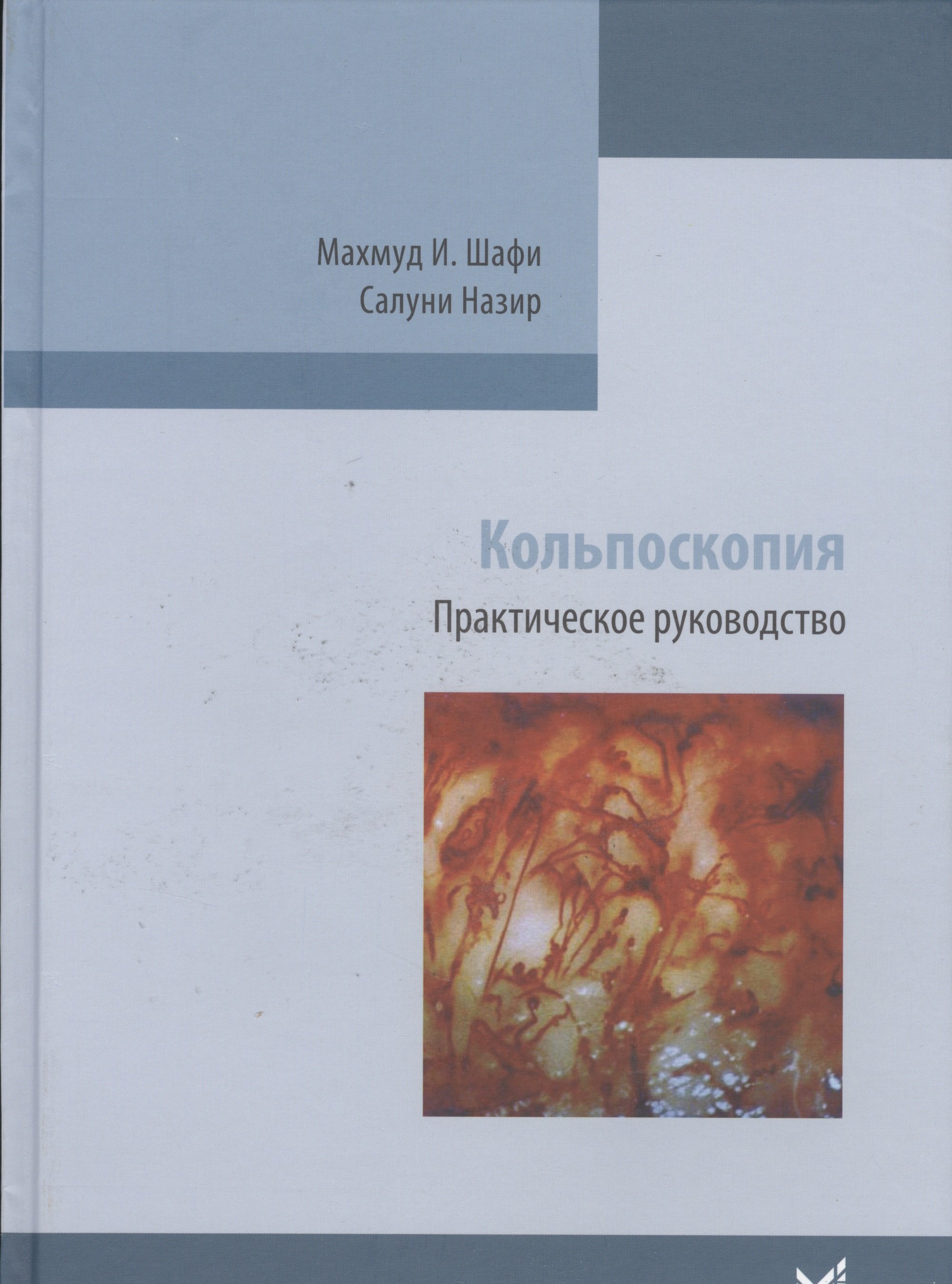 

Кольпоскопия.