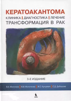 Кератоакантома. Клиника, диагностика, лечение, трансформация в рак. 3-е издание — 2625698 — 1