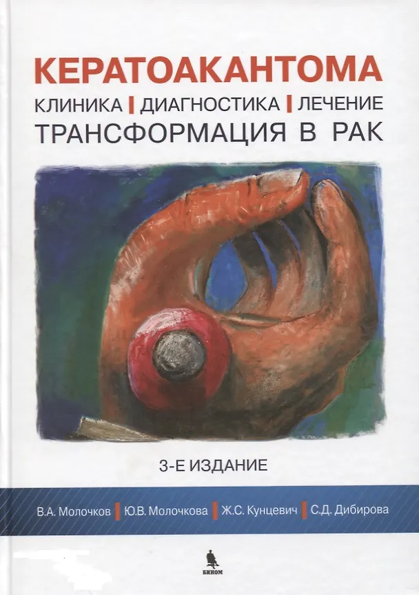 Книга Кератоакантома. Клиника, диагностика, лечение, трансформация в рак. 3-е издание (Владимир Молочков, Юлия Молочкова, Ж.С. Кунцевич, С.Д. Дибирова) — 1