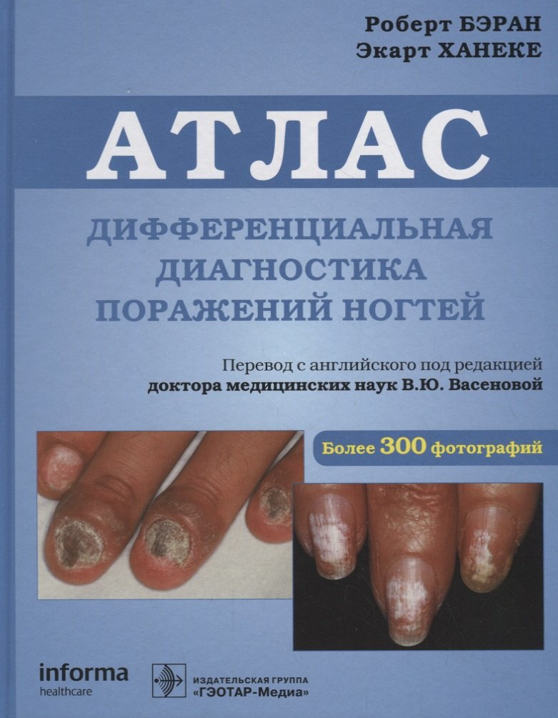

Атлас. Дифференциальная диагностика поражений ногтей