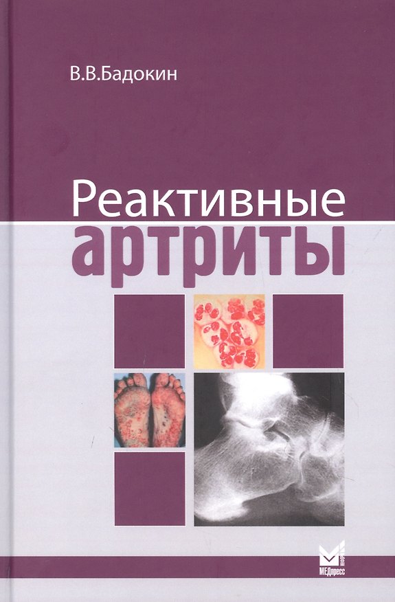 Книга Реактивные артриты (Владимир Бадокин) — 1