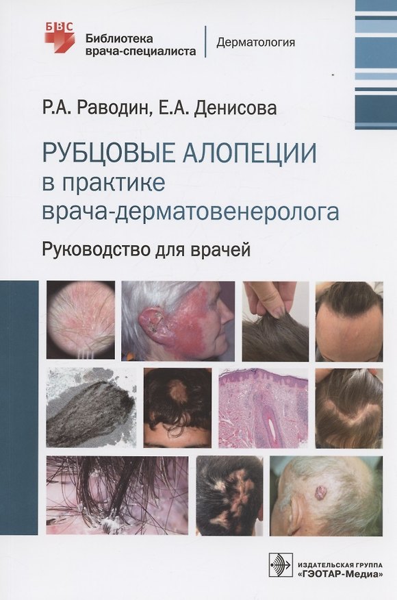 Книга Рубцовые алопеции в практике врача-дерматовенеролога. Руководство для врачей (Роман Раводин, Екатерина Денисова) — 1