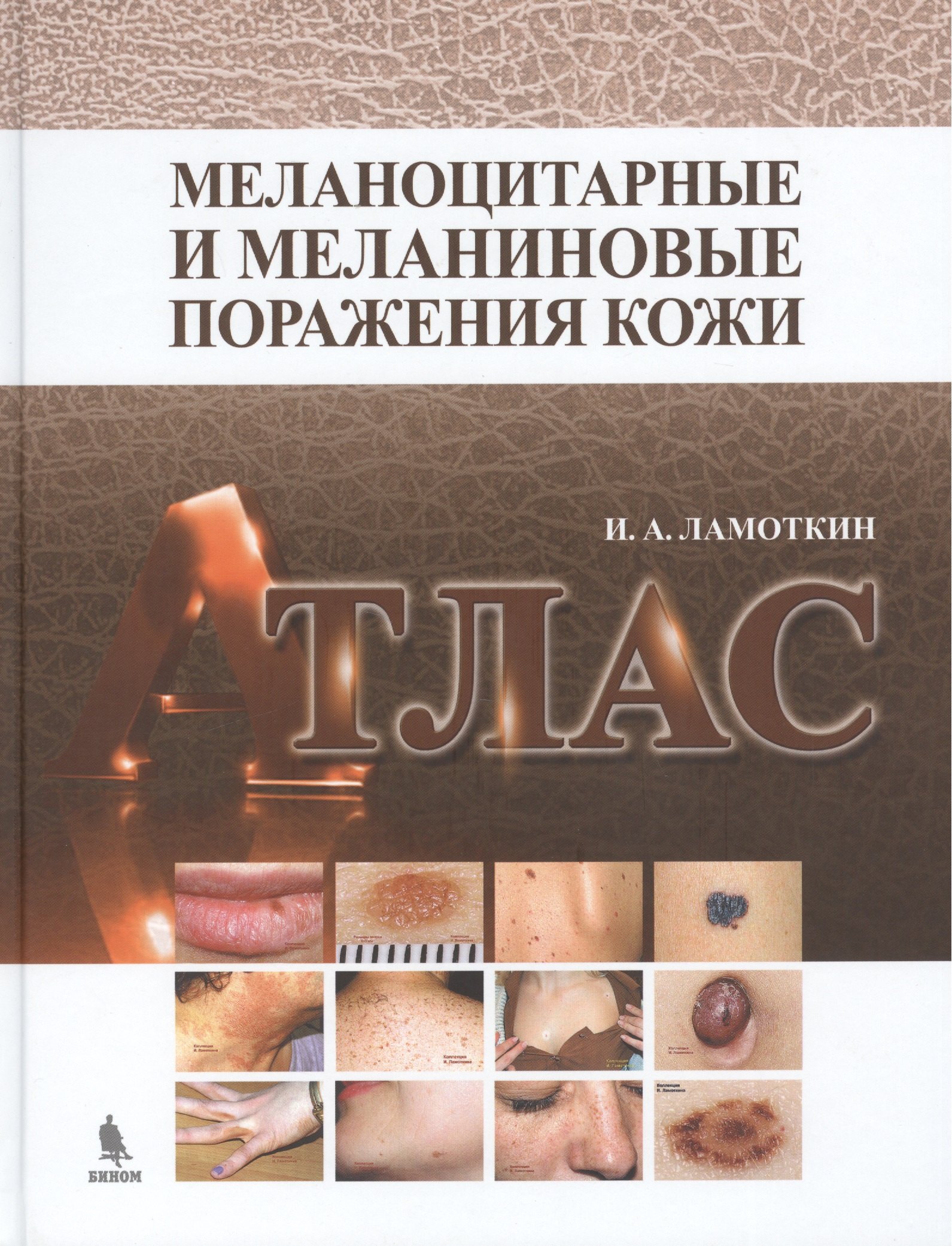 

Меланоцитарные и меланиновые поражения кожи: учебное пособие