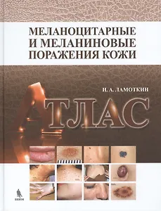 Меланоцитарные и меланиновые поражения кожи: учебное пособие