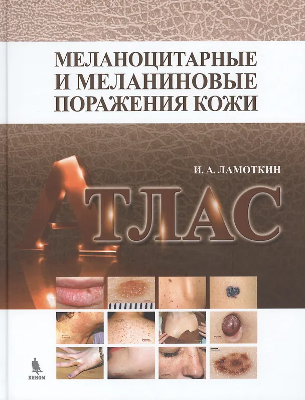 Книга Меланоцитарные и меланиновые поражения кожи: учебное пособие (Игорь Ламоткин) — 1