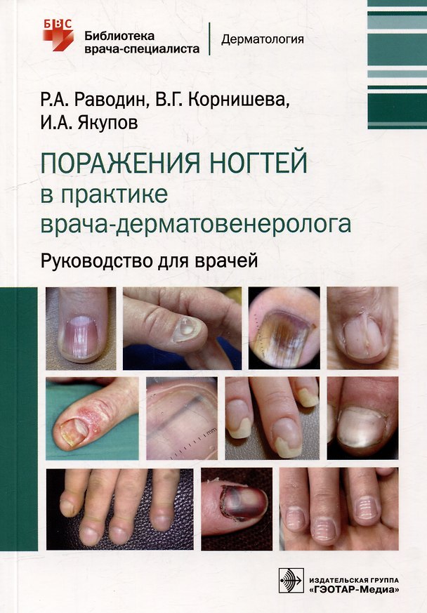 Книга Поражения ногтей в практике врача-дерматовенеролога: руководство для врачей (Роман Раводин, Вера Корнишева, Ильяс Якупов) — 1