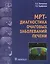 МРТ-диагностика очаговых заболеваний печени. — 2571391 — 1