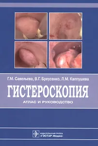 Гистероскопия : атлас и руководство. 2-е издание, дополненное и переработанное