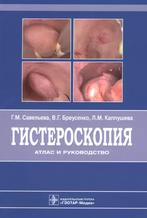 Гистероскопия : атлас и руководство. 2-е издание, дополненное и переработанное — 2608716 — 1