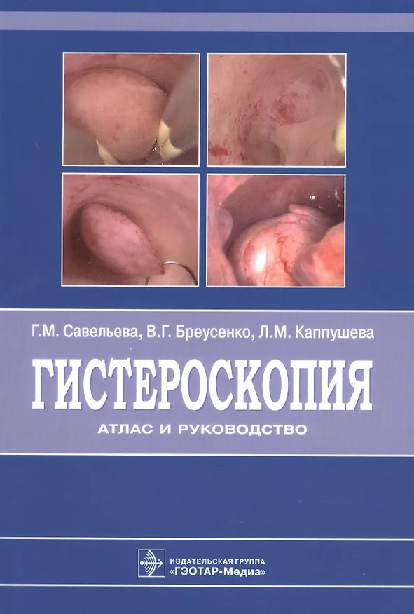 Книга Гистероскопия : атлас и руководство. 2-е издание, дополненное и переработанное (Галина Савельева, Валентина Бреусенко, Лаура Каппушева) — 1