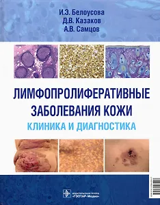 Лимфопролиферативные заболевания кожи. Клиника и диагностика