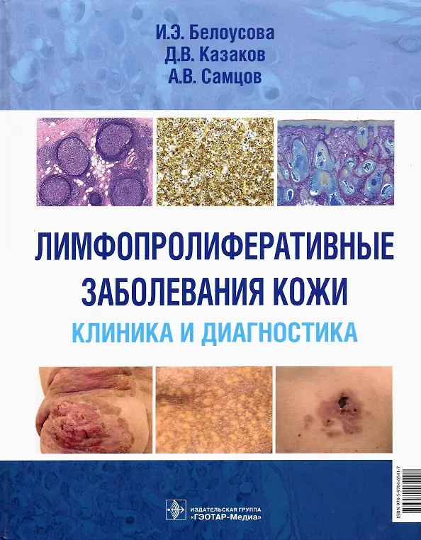 Книга Лимфопролиферативные заболевания кожи. Клиника и диагностика () — 1