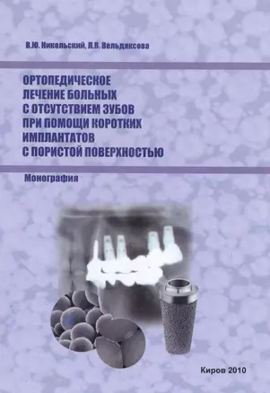 Ортопедическое лечение больных с отсутствием зубов при помощи коротких имплантатов с пористой поверхностью — 2491959 — 1