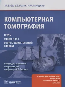 Компьютерная томография.