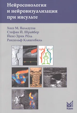 Книга Нейросонология и нейровизуализация при инсульте (Хосе М. Вальдуэза, Стефан Й. Шрайбер, Йенс-Эрик Рёль, Рандольф Клингебиль)