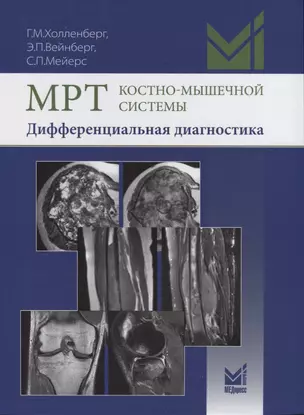 МРТ костно-мышечной системы. Дифференциальная диагностика — 2651165 — 1