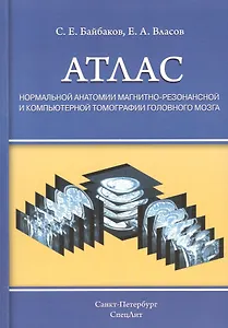 Атлас нормальной анатомии магнитно-резонансной и компьютерной томографии головного мозга : уебное пособие
