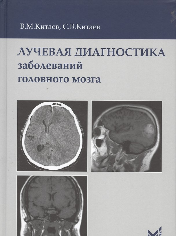 Книга Лучевая диагностика заболеваний головного мозга (Вячеслав Китаев) — 1