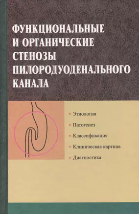 Функциональные и органические стенозы пилородуоденального канала — 2377851 — 1