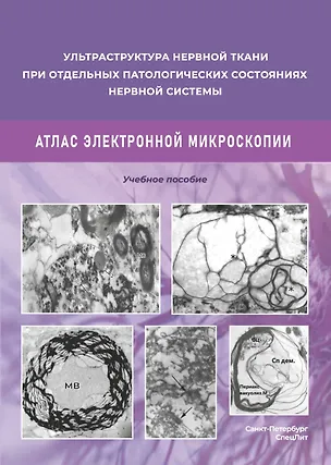 Книга Ульстраструктура нервной ткани при отдельных патологических состояниях нервной системы. Атлас  электронной микроскопии. (Дмитрий Коржевский, Мирослав Одинак)