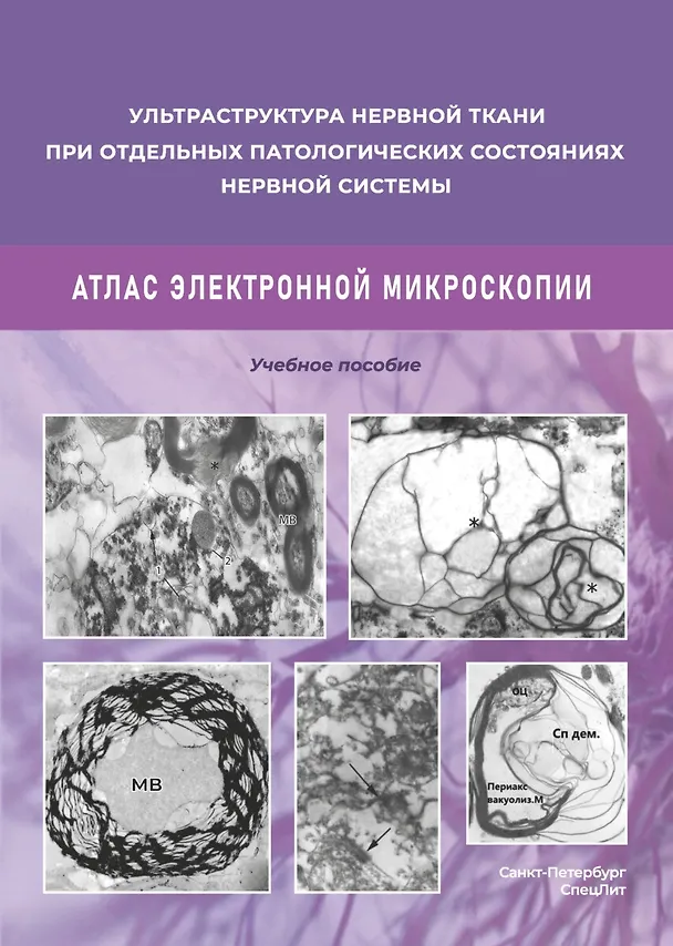 Книга Ульстраструктура нервной ткани при отдельных патологических состояниях нервной системы. Атлас  электронной микроскопии. (Дмитрий Коржевский, Мирослав Одинак) — 1