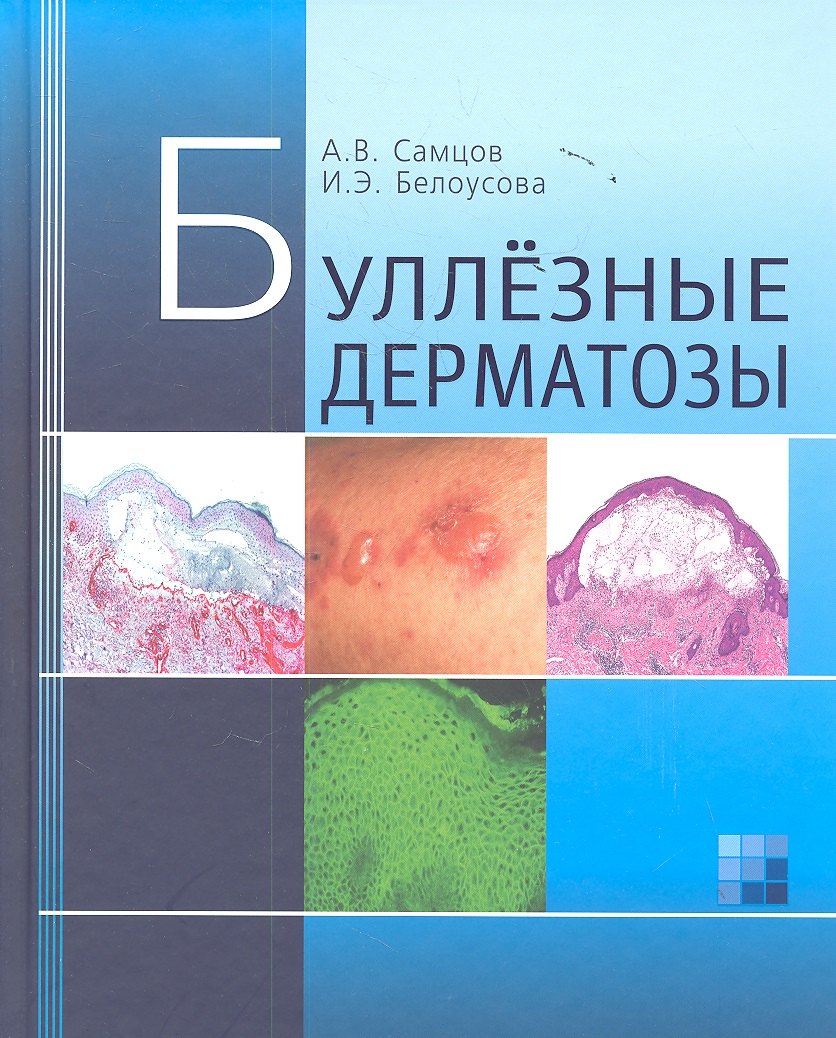 

Буллезные дерматозы