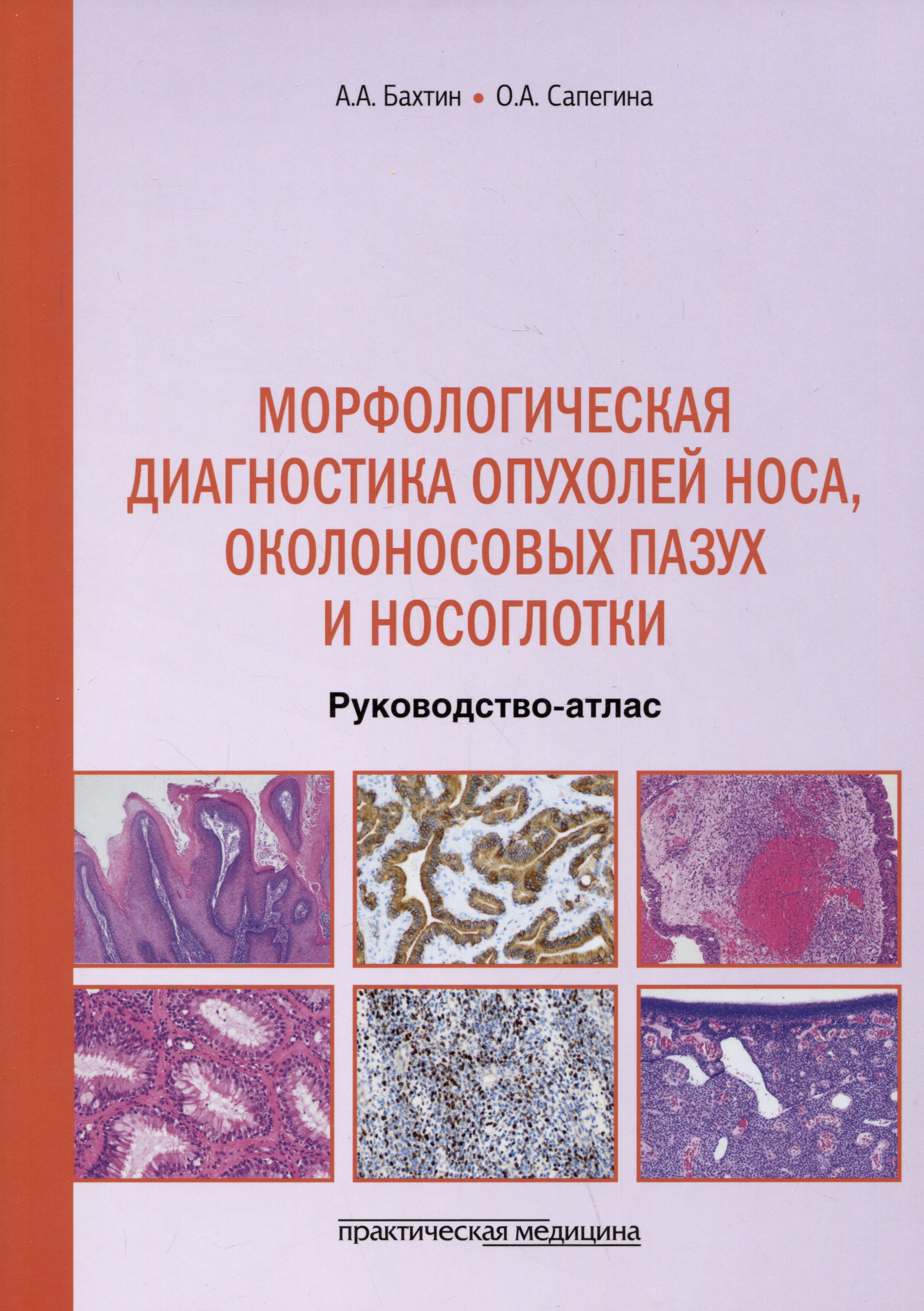 

Морфологическая диагностика опухолей носа, околоносовых пазух и носоглотки. Руководство-атлас