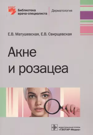 Акне и розацеа — 2742268 — 1