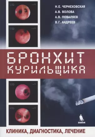 Бронхит курильщика. Клиника, диагностика, лечение — 2768504 — 1