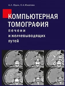 Компьютерная томография печени и желчевыводящих путей: практическое руководство.