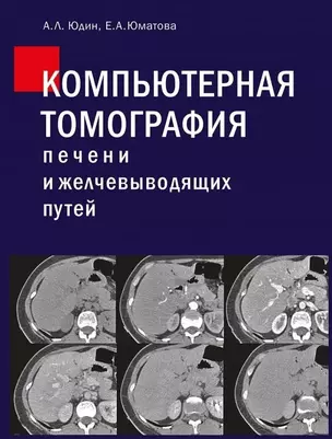 Компьютерная томография печени и желчевыводящих путей: практическое руководство. — 3001277 — 1