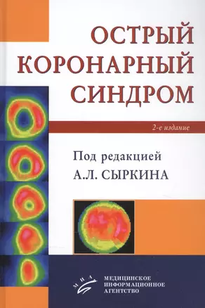 Острый коронарный синдром — 2838741 — 1