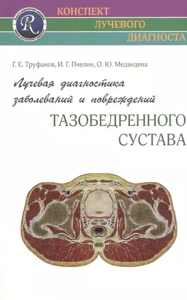 Лучевая диагностика заболеваний и повреждений тазобедренного сустава — 2364931 — 1