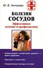 Болезни сосудов — 2109799 — 1