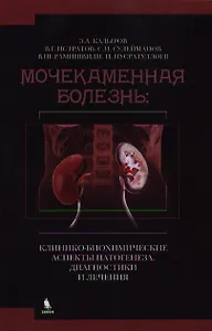 Мочекаменная болезнь: клинико - биохимические аспекты патогенеза, диагностики и  лечения