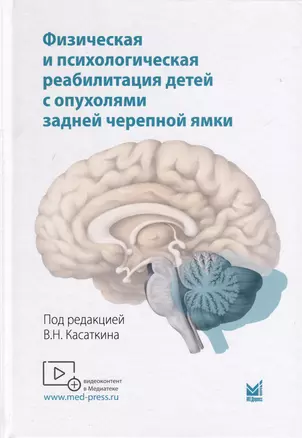 Физическая и психологическая реабилитация детей с опухолями задней черепной ямки — 3018742 — 1