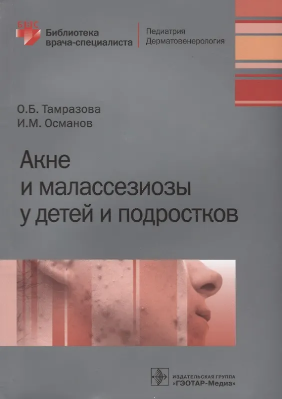 Книга Акне и малассезиозы у детей и подростков () — 1