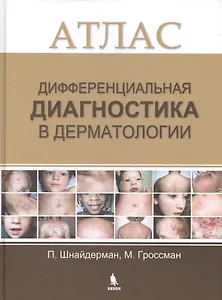 Дифференциальная диагностика в дерматологии. Атлас