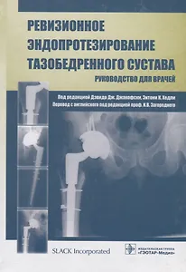 Ревизионное эндопротезирование тазобедренного сустава: руководство для врачей