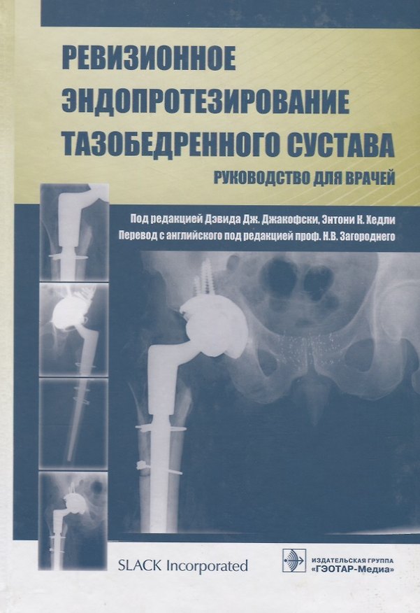 Книга Ревизионное эндопротезирование тазобедренного сустава: руководство для врачей () — 1