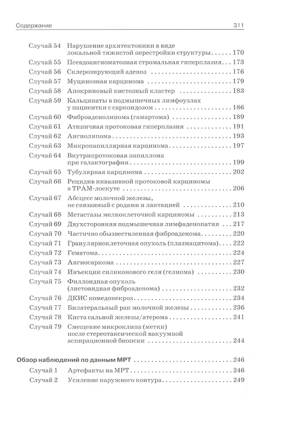 Книга Лучевая диагностика заболеваний молочной железы () — 4