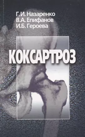 Коксартроз — 2754643 — 1